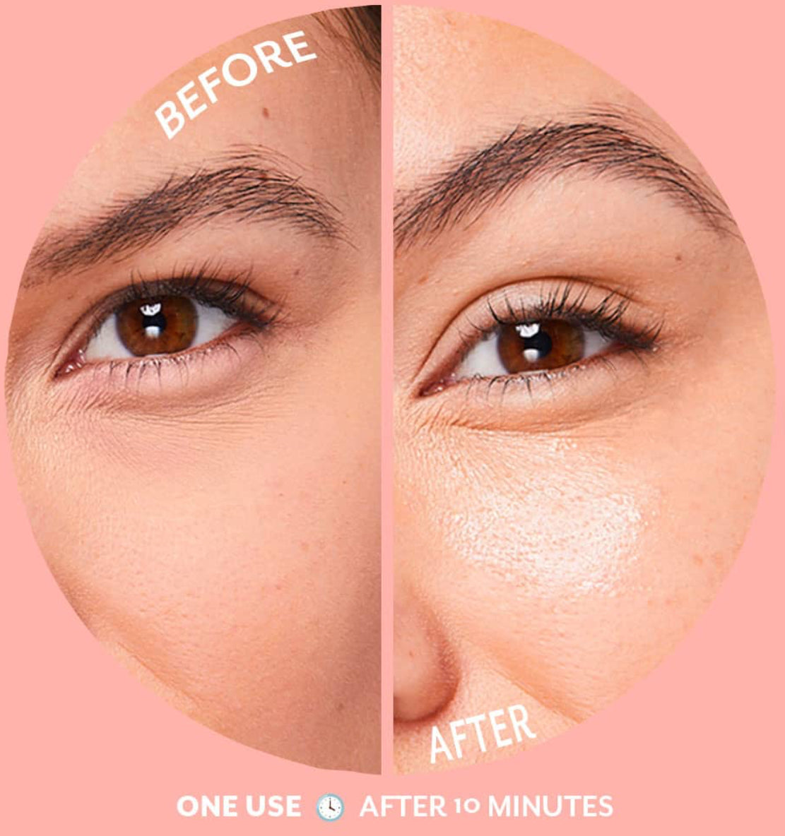 Bubbly Eye Gels